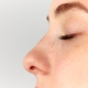 Are You a Good Candidate for the Awake Rhinoplasty?