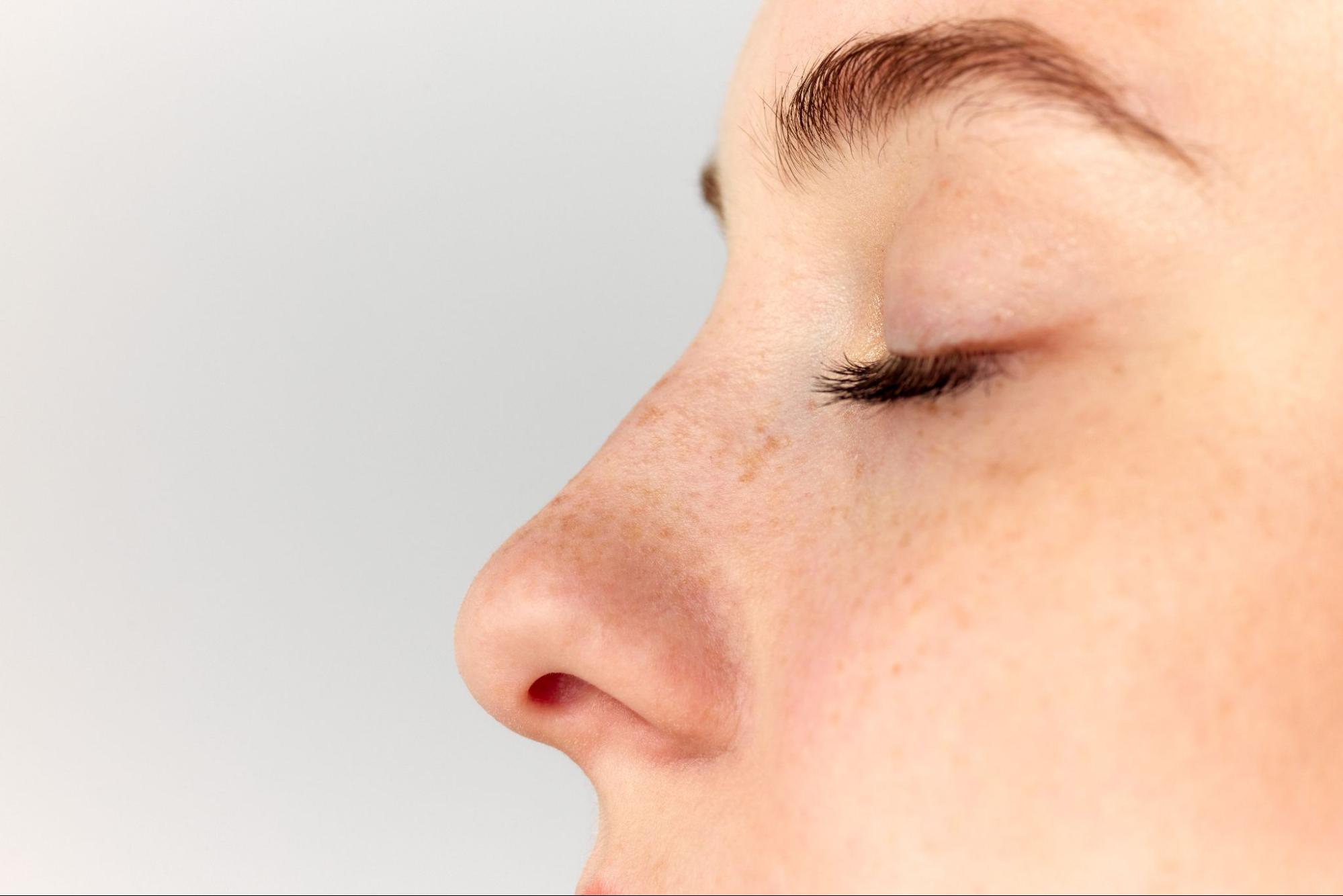 Are You a Good Candidate for the Awake Rhinoplasty?