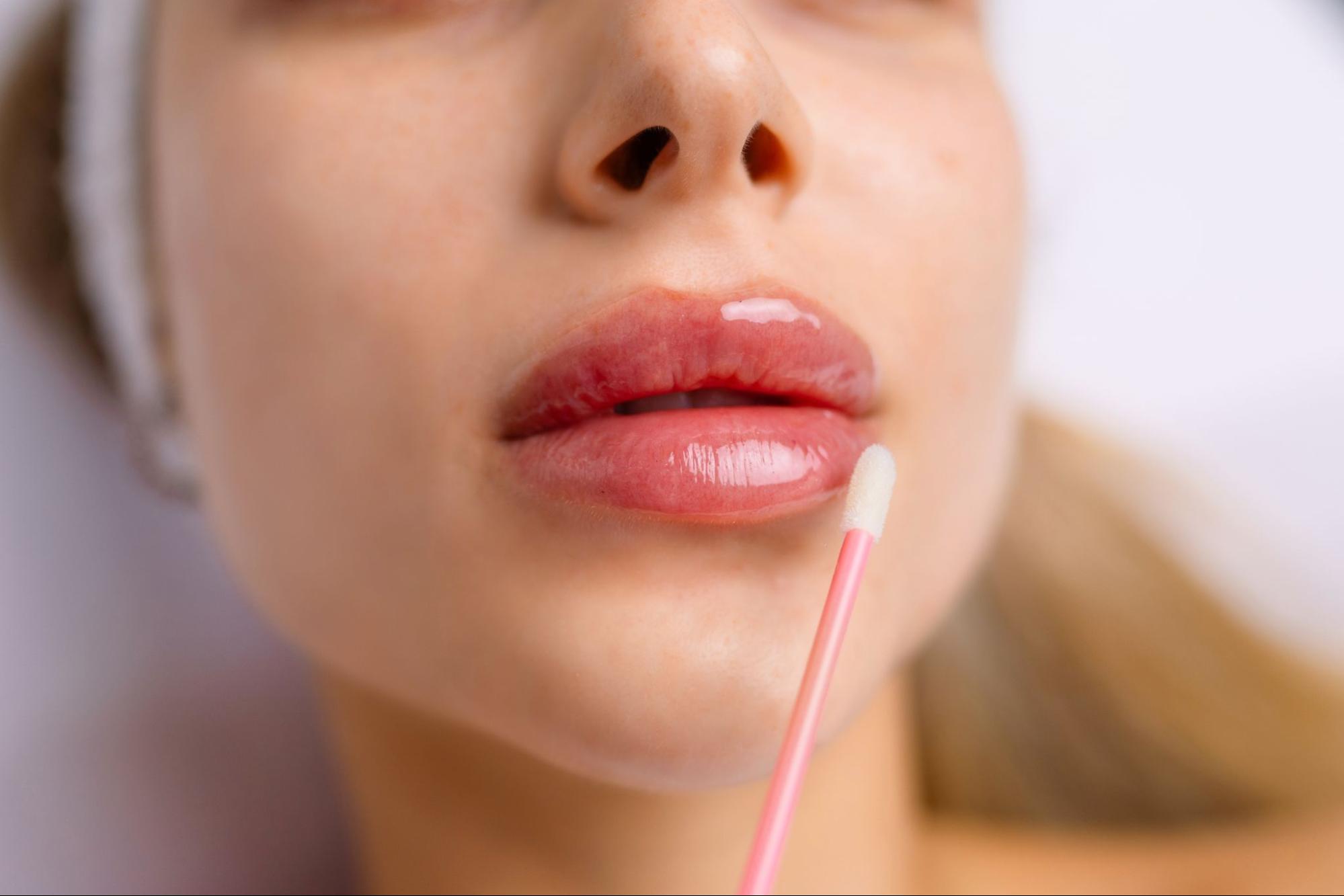 The Real Difference Between Lip Lift vs Fillers